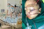 Bé trai 5 tuổi bị bố chém khâu hơn 300 mũi, bệnh viện cấp cứu mức 'báo động đỏ'