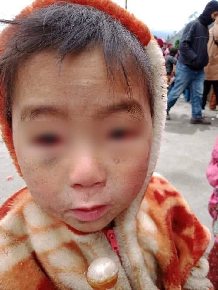 Xót xa ảnh em bé vùng cao mắt đỏ ngầu vì thời tiết lạnh thấu xương-4