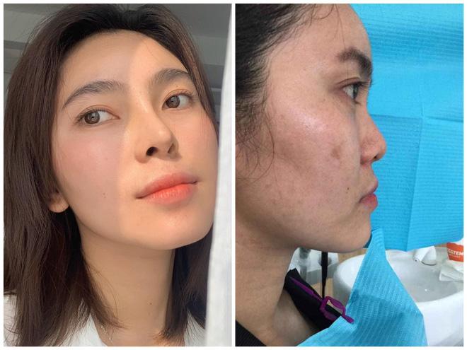 Màn lột xác ngoạn mục của nhiếp ảnh gia, bỏ 200 triệu và tất cả phải choáng sau 3 năm-12