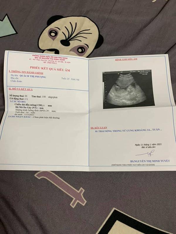 Nhan sắc Thị Nở Quách Phượng thay đổi bất ngờ sau hơn 1 tháng tái hôn-4