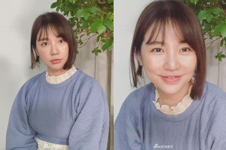 Mới đây, Yoon Eun Hye chia sẻ loạt ảnh mới trên trang cá nhân. Trong ảnh cô trang điểm nhạt nhòa, diện trang phục đơn giản. Nhiều cư dân mạng bày tỏ gương mặt nữ diễn viên có nhiều phần khác biệt so với trước đây. Yoon Eun Hye từng vướng vào nghi án phẫu thuật thẩm mỹ khiến cho gương mặt thay đổi, bị chê xuống sắc.