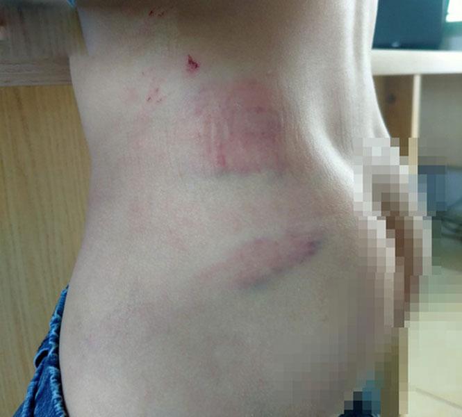 Clip: Bé trai 9 tuổi ở Gia Lai kể bị bố bạo hành toác đầu, mẻ răng-2