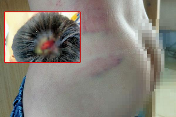 Clip: Đàn khỉ đuôi dài đại náo trong khu dân cư ở TP.HCM, bắn thuốc mê di rời-7