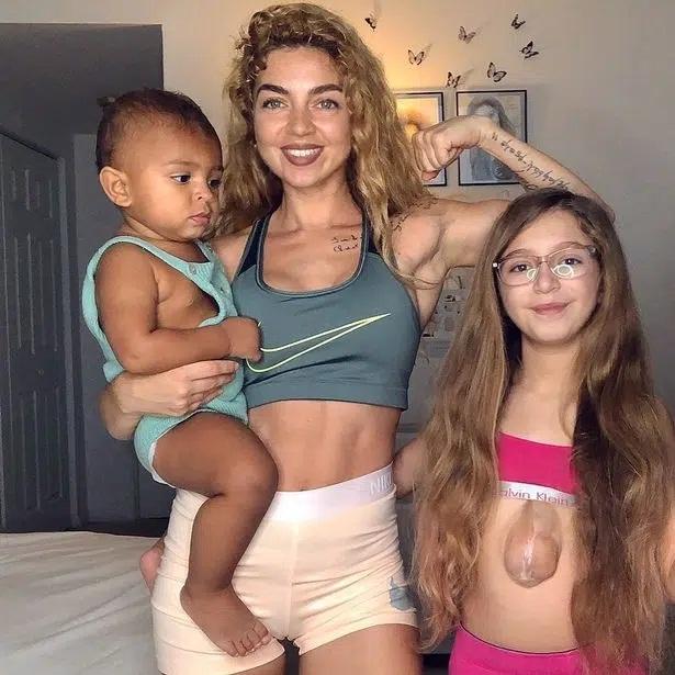 Bé gái sinh ra với trái tim nằm ngoài lồng ngực 11 năm trước giờ thế nào?-2