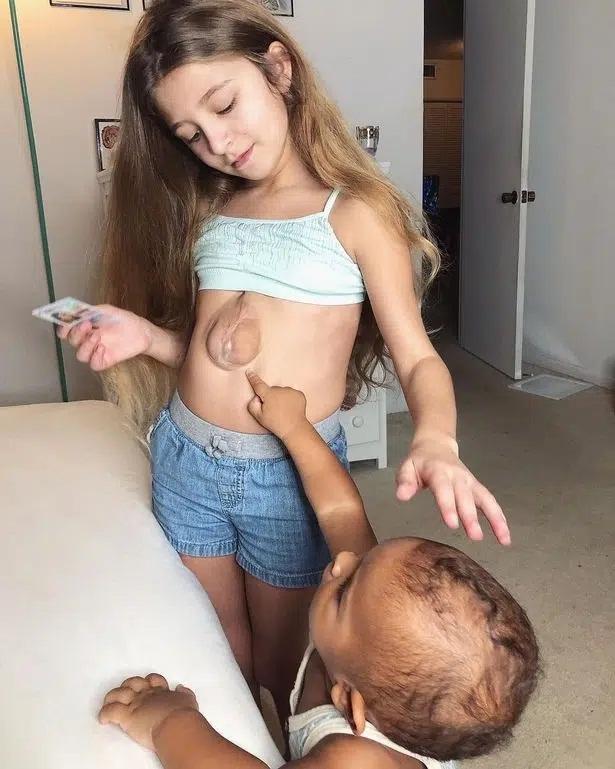 Bé gái sinh ra với trái tim nằm ngoài lồng ngực 11 năm trước giờ thế nào?-3