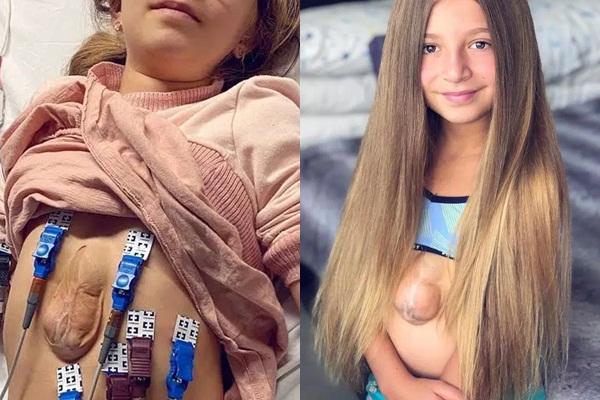 Bất ngờ ngoại hình hiện tại của cậu bé 11 tuổi nặng 382 kg-6