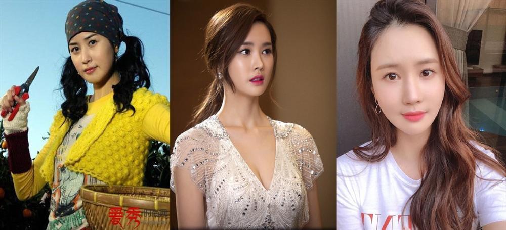 Ám ảnh ngoại hình đẩy nghệ sĩ nữ châu Á vào cuộc đua ‘dao kéo’-3