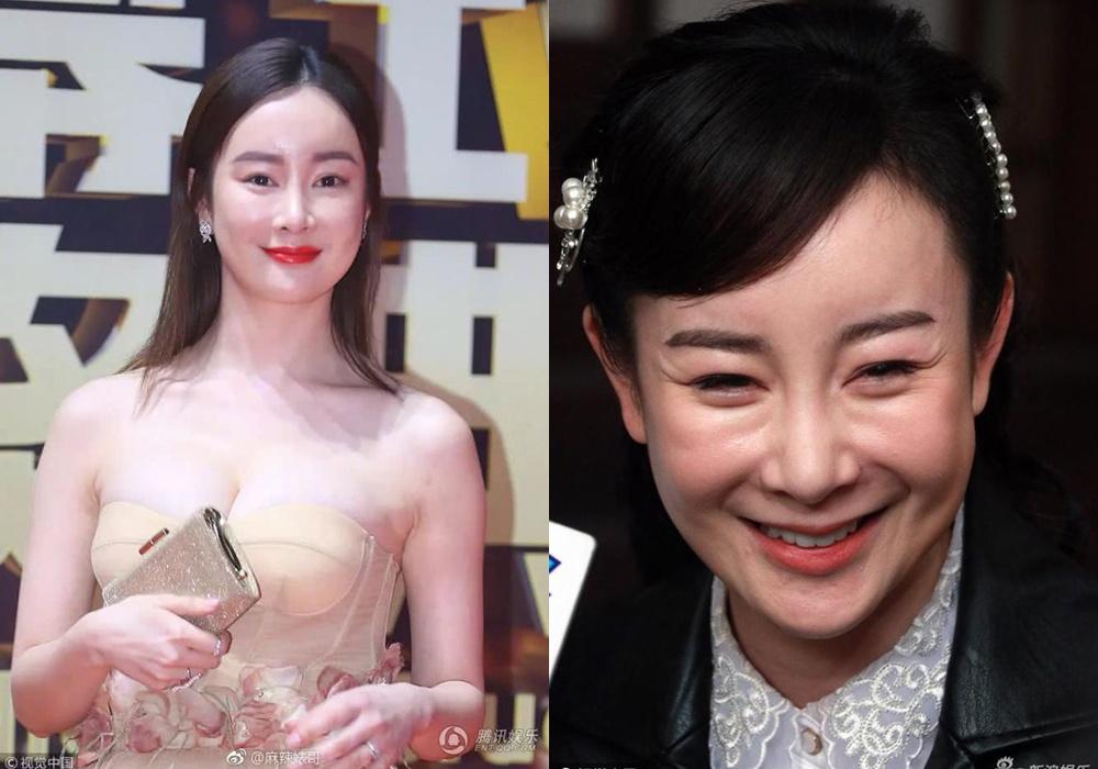 Ám ảnh ngoại hình đẩy nghệ sĩ nữ châu Á vào cuộc đua ‘dao kéo’-5