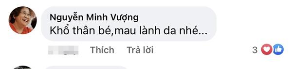 Sao Việt xót xa khi Phương Oanh bị thương trong lúc quay phim-3