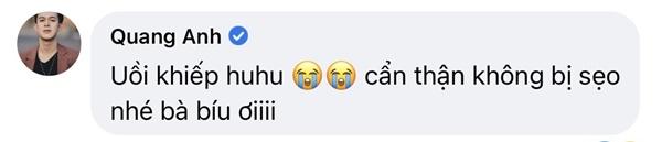 Sao Việt xót xa khi Phương Oanh bị thương trong lúc quay phim-6