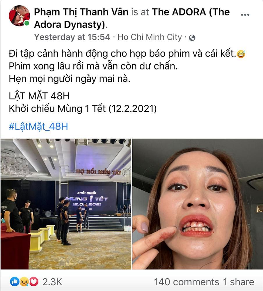 Mạc Văn Khoa phải uống thuốc, Ốc Thanh Vân chảy máu miệng khi tham gia Lật mặt 5: 48H-4