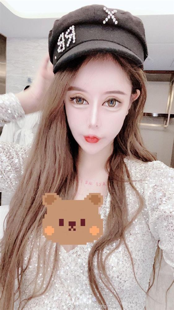 Sốc nghe hot girl thẩm mỹ kể chuyện hơn 100 lần dao kéo nhớ đời-7