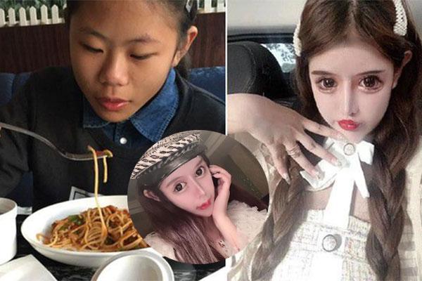 Chàng trai Hưng Yên đập mặt 20 lần đến bố mẹ cũng không nhận ra-6