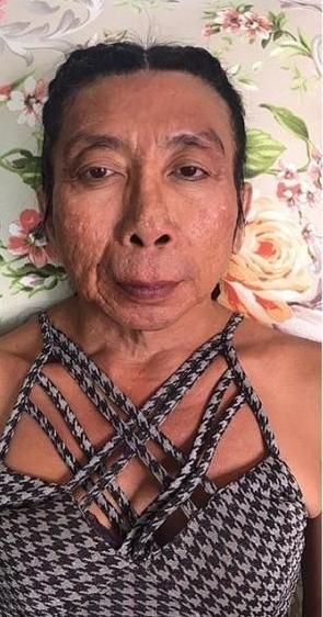 Gương mặt nát bươm hết vía của gái già chuyển giới Thái Lan-1