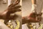Vừa sạc điện thoại vừa chơi game, nam sinh 15 tuổi ở Bình Phước bị nổ nát tay