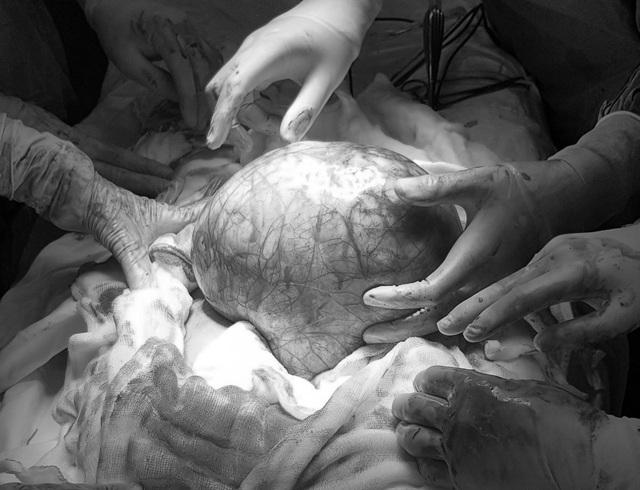 Người đàn ông mang bầu sau khi uống... thực phẩm chức năng-1