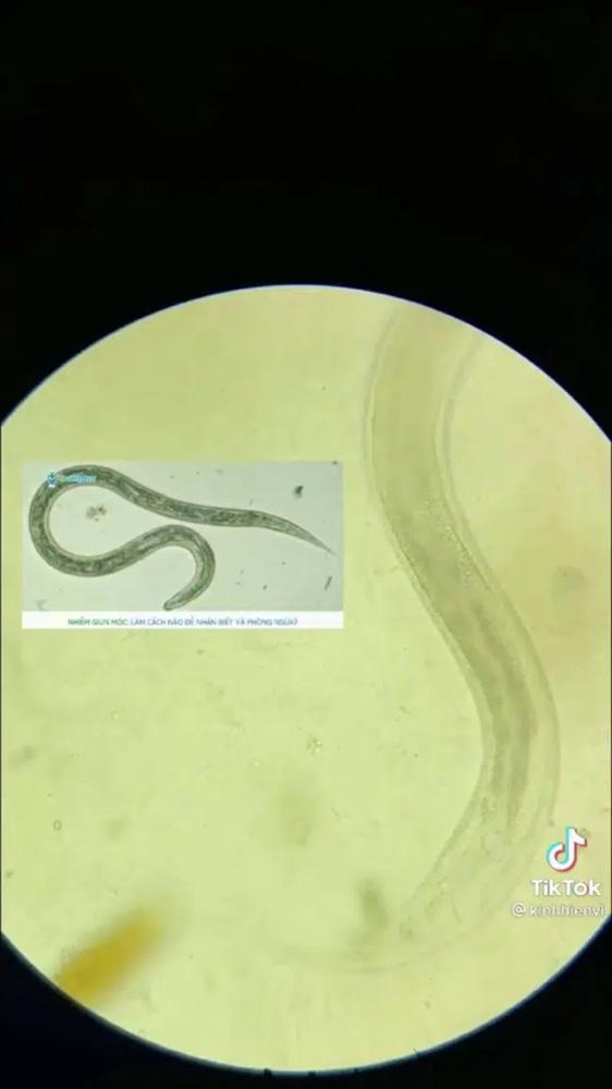 Rùng mình xem clip soi tương ớt vỉa hè dưới kính hiển vi-2