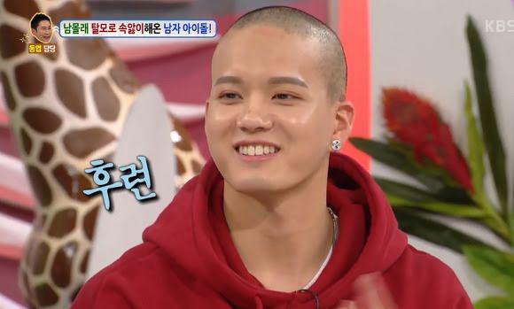 Những Idols can đảm thừa nhận mình mắc bệnh... hói đầu-1