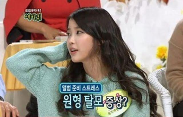 Những Idols can đảm thừa nhận mình mắc bệnh... hói đầu-4