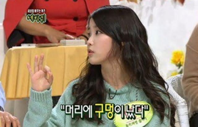 Những Idols can đảm thừa nhận mình mắc bệnh... hói đầu-5