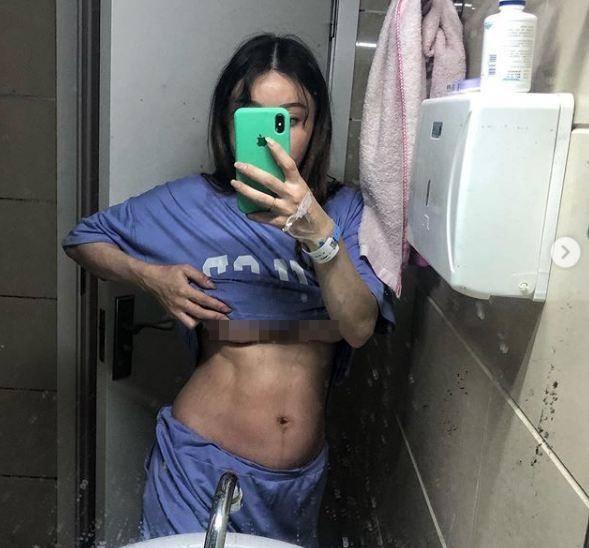 Bất ngờ cặp tuyết lê ngày càng khủng của bác sĩ cơ bắp sau 1 năm nổi tiếng-2