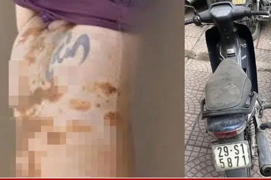 Phát hiện 1 thi thể ở sông Hồng, trên người có hình xăm lạ 'Mxhqm'