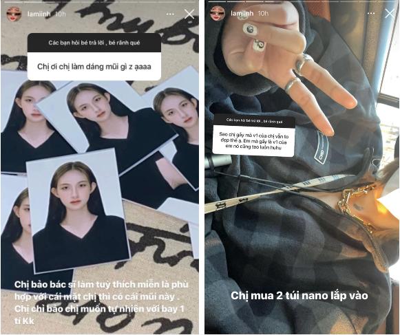 Bạn gái tin đồn Decao công khai thẩm mỹ, nhan sắc trước dao kéo vẫn xinh-3