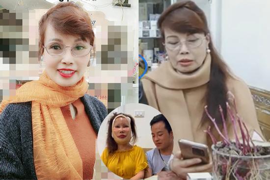 Gương mặt đơ cứng, méo lệch của cô dâu 64 tuổi sau hơn nửa năm dao kéo