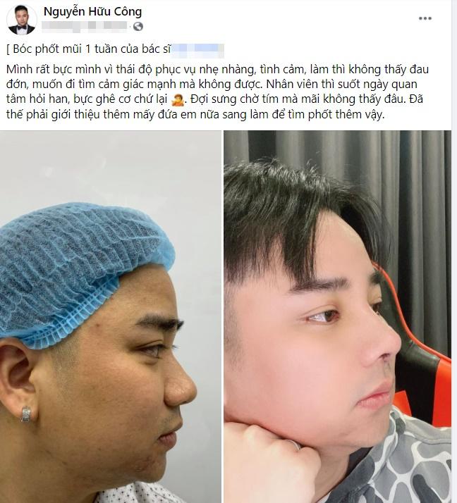 Hữu Công thay đổi 180 độ sau 2 năm lấy vợ-1