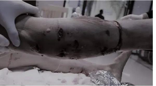 Kinh hoàng: Chó Pitbull nặng 40kg nổi điên tấn công liên tiếp 2 người nhập viện-1