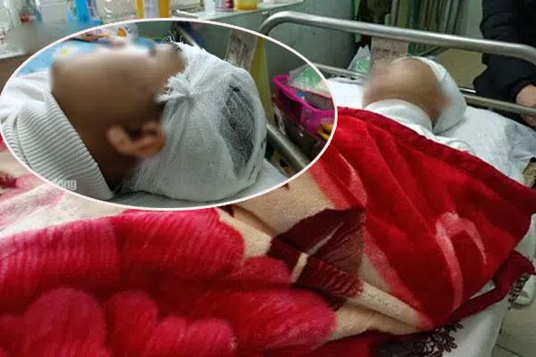 Nam sinh lớp 11 đánh bạn vỡ sọ não có bị xử lý hình sự?-4