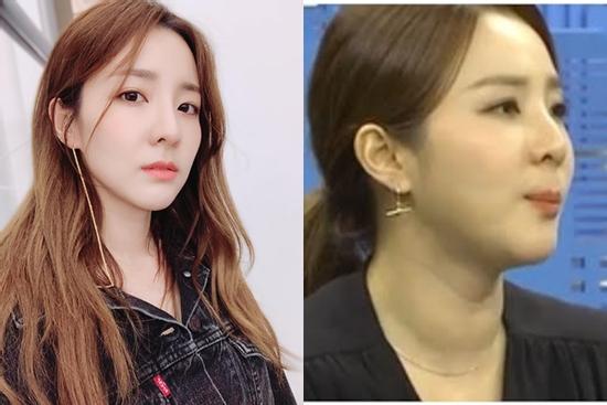 Sandara gây lo lắng về ngoại hình thay đổi bất thường