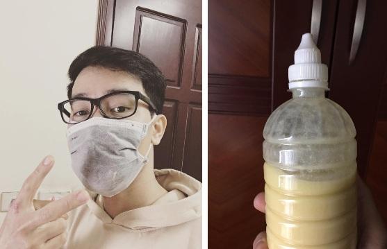 Chàng trai phải ăn sinh tố mì tôm vì gãy mất 3 chiếc răng-2