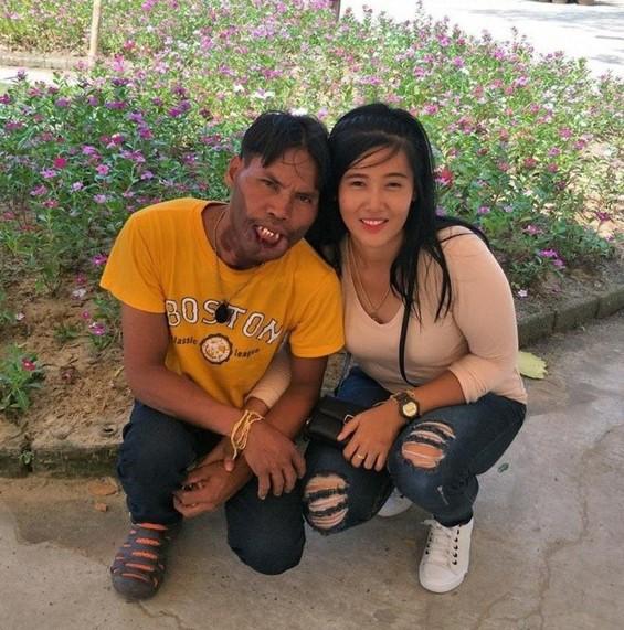 Cuộc sống không như mơ của anh chàng mặt quỷ sau 3 năm lấy vợ xinh đẹp-1