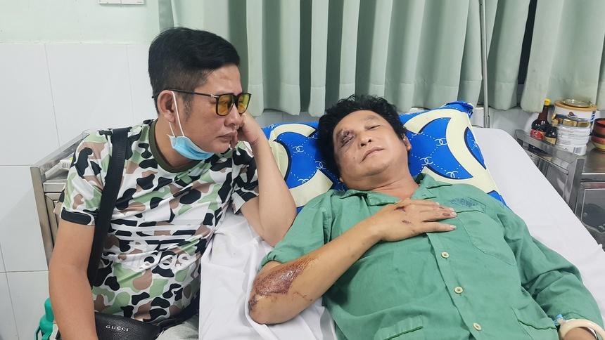 Nghệ sĩ Trọng Phúc bị tai nạn, chấn thương mặt và vai-1
