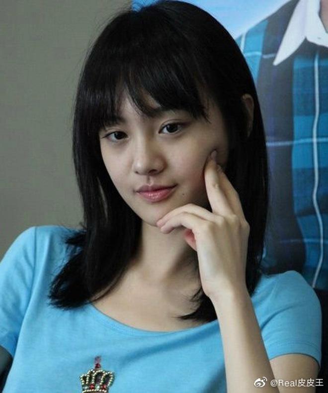 Trịnh Sảng tuột dốc nhan sắc lẫn sự nghiệp sau khi phẫu thuật thẩm mỹ-1