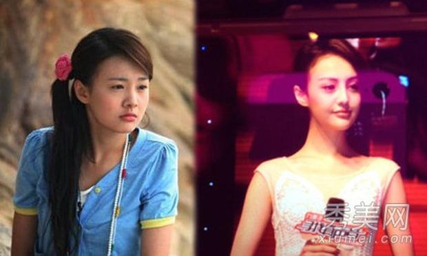 Trịnh Sảng tuột dốc nhan sắc lẫn sự nghiệp sau khi phẫu thuật thẩm mỹ-3