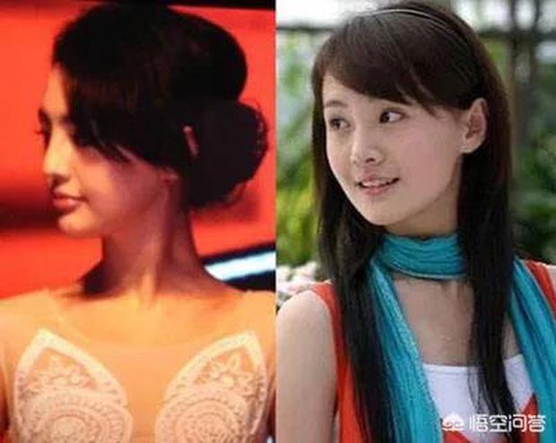 Trịnh Sảng tuột dốc nhan sắc lẫn sự nghiệp sau khi phẫu thuật thẩm mỹ-4