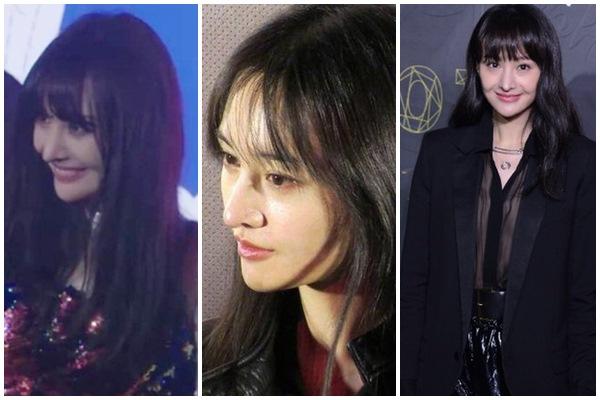 Xăm môi 2 triệu đón Tết, cô gái nhận cái kết sưng tều như mỏ chim-11