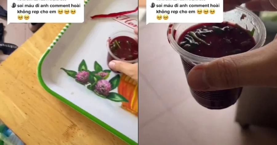 Thứ kinh dị bên trong bát tiết canh qua kính hiển vi: Xem xong đảm bảo thèm cũng chẳng dám ăn-1