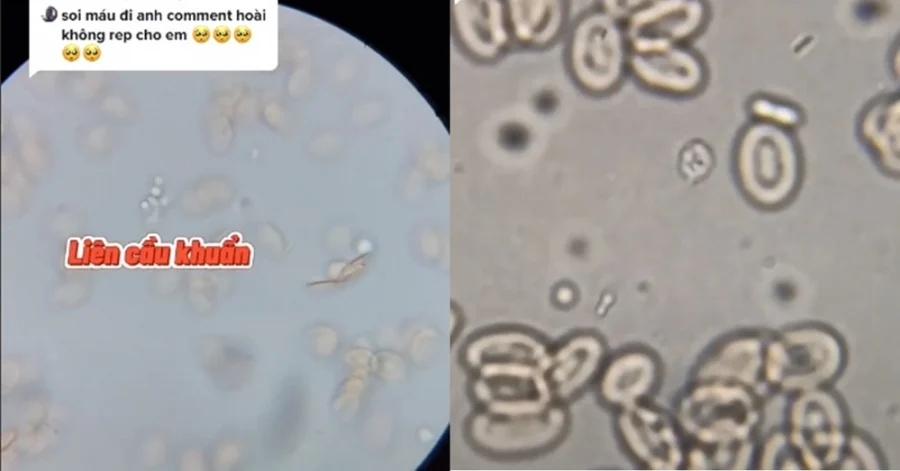 Thứ kinh dị bên trong bát tiết canh qua kính hiển vi: Xem xong đảm bảo thèm cũng chẳng dám ăn-2