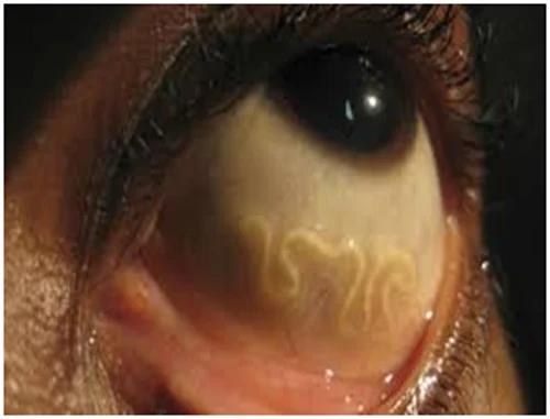 Thứ kinh dị bên trong bát tiết canh qua kính hiển vi: Xem xong đảm bảo thèm cũng chẳng dám ăn-4