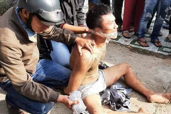 Tông vào cụ ông gây nguy kịch, tài xế say xỉn líu cả lưỡi không còn tự chủ-1