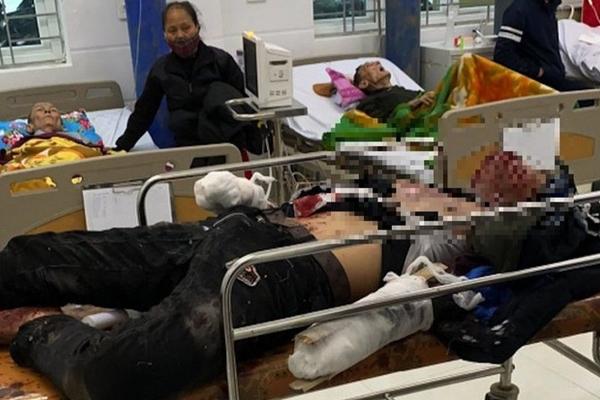 Lên mạng học cách chế pháo nổ chơi Tết, 2 thanh niên gặp nạn, bỏng nặng toàn thân-2