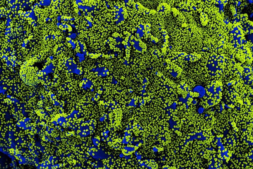 Hiện tượng bí ẩn của bệnh nhân mắc Covid-19-2