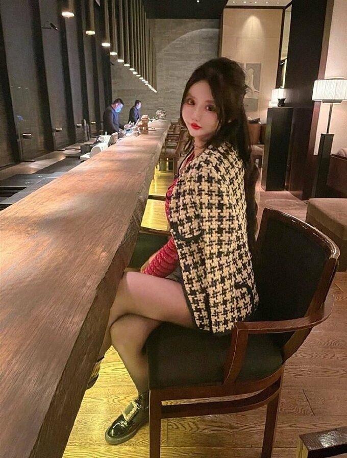 Chi 14 tỷ phẫu thuật thẩm mỹ 100 lần, cô gái bị biến dạng khuôn mặt-7