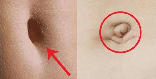 Nhìn tướng rốn 3 giây biết ngay tính cách và tương lai của bạn như thế nào-1