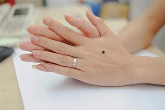 Xòe bàn tay xem có nốt ruồi ở vị trí này là người vận khí đại cát, nhân duyên viên mãn trọn đời