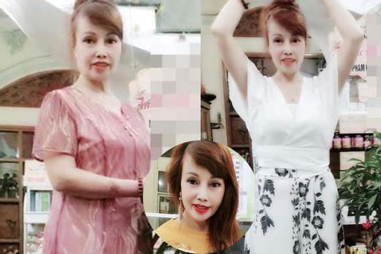 Cô dâu Cao Bằng gây sốc khi lộ cằm nhọn hoắt như muốn xuyên thủng vạn vật