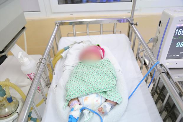Bé sơ sinh bị bỏ rơi ngày giáp Tết trong tình trạng suy hô hấp-1